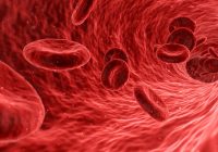 Zu hoher Cholesterin Wert im Blut auf koerperfett-analyse.de